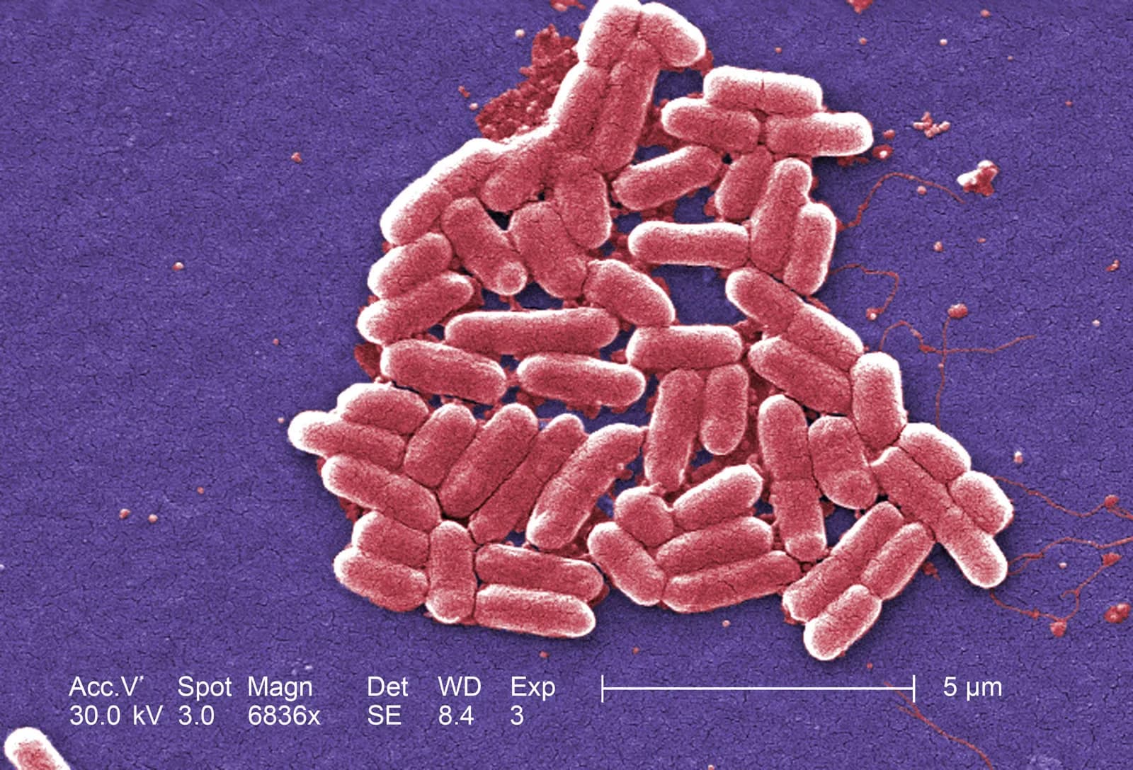 Bakteri Escherichia coli.