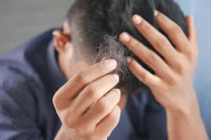 Sering Ikat Rambut Terlalu Kencang? Kebiasaan Ini Bisa Picu Alopecia Traction