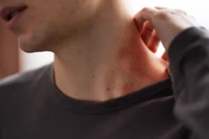 Muncul Benjolan di Tubuh? Jangan Asal Dipencet, Ini yang Perlu Diketahui soal Lipoma
