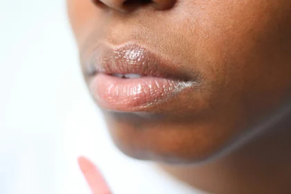 Kondisi bibir lembap.