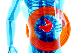 Ilustrasi Fatty Liver Kini Banyak Menyerang Usia 30-an